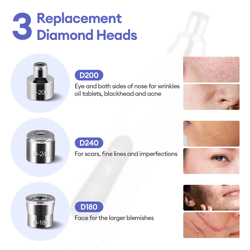 3-Tip Portable Diamond Microdermabrasion & Vacuum Blackhead Remover