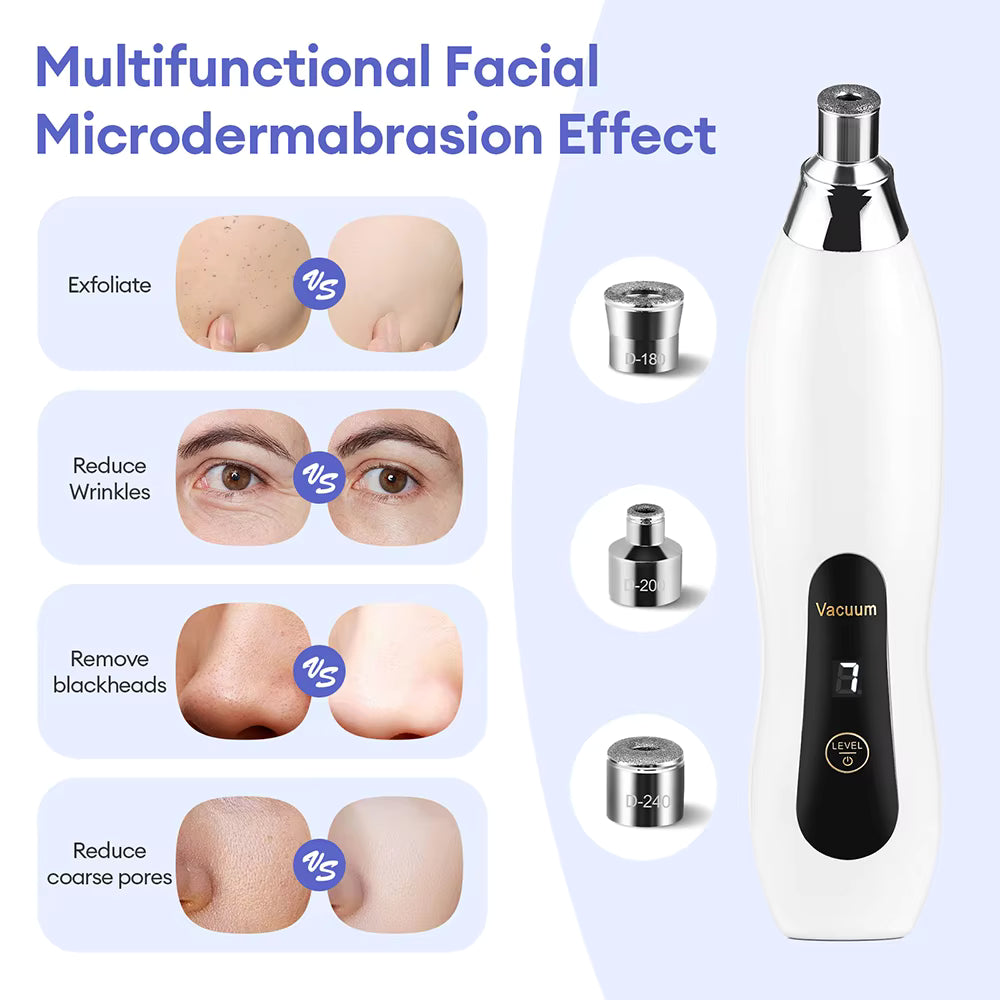 3-Tip Portable Diamond Microdermabrasion & Vacuum Blackhead Remover
