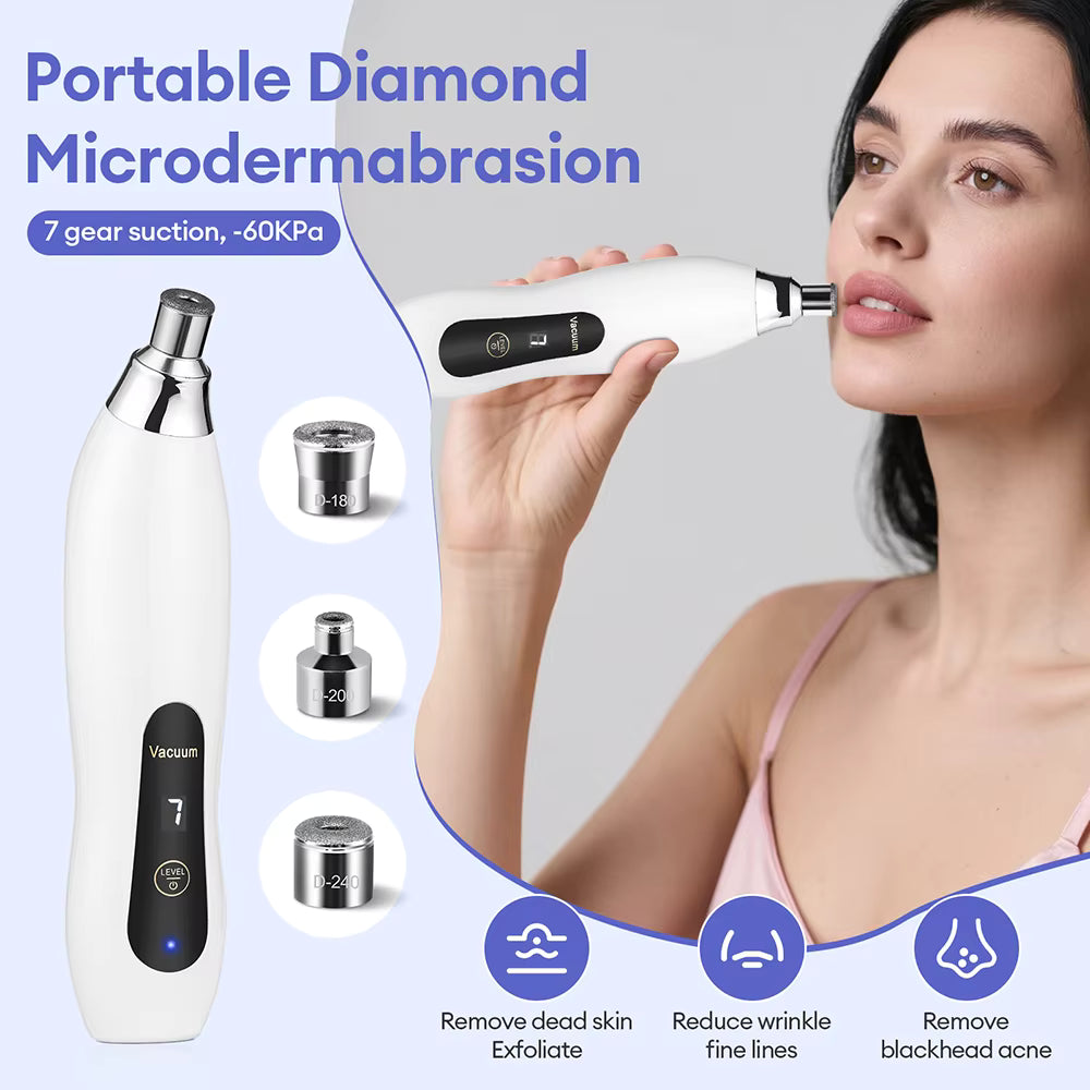 3-Tip Portable Diamond Microdermabrasion & Vacuum Blackhead Remover