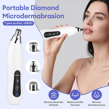 3-Tip Portable Diamond Microdermabrasion & Vacuum Blackhead Remover